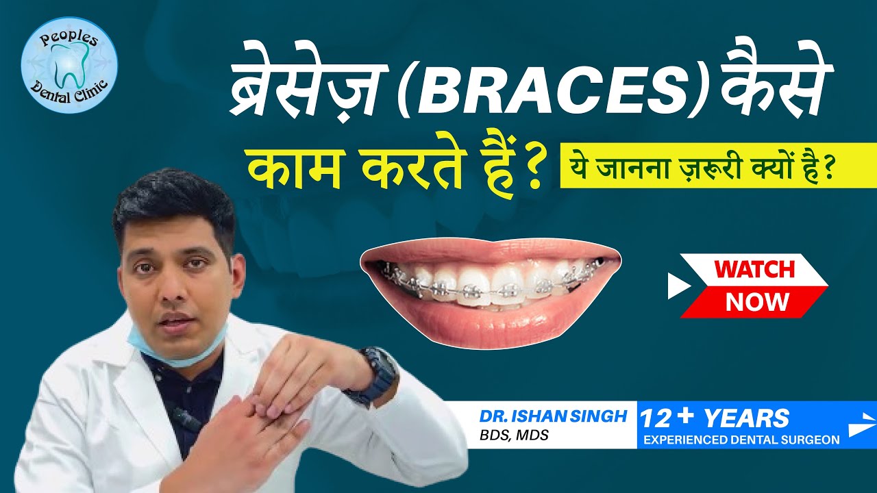 How do Braces Work Hindi | How Braces move teeth | How do Braces work to straighten Teeth | Dr Ishan