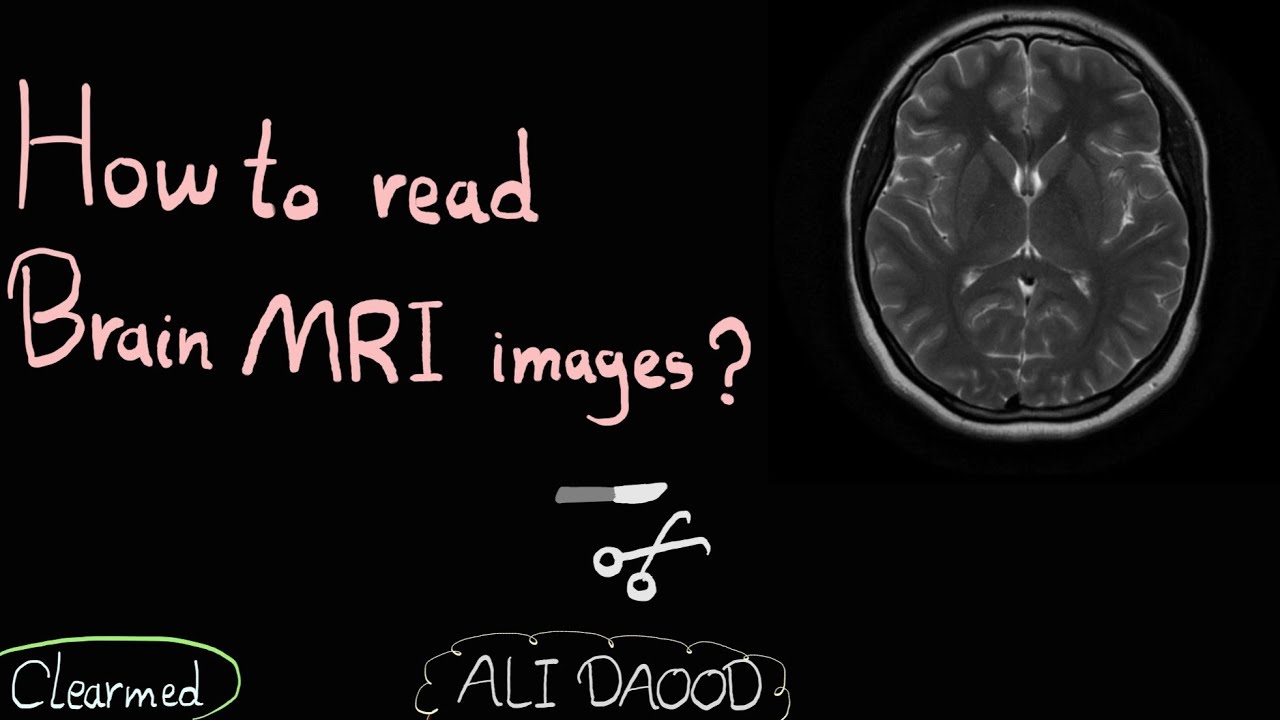 How to Read Brain MRI images? | شرح كيفية قراءة مقاطع الدماغ (التصوير بالرنين المغناطيسي)