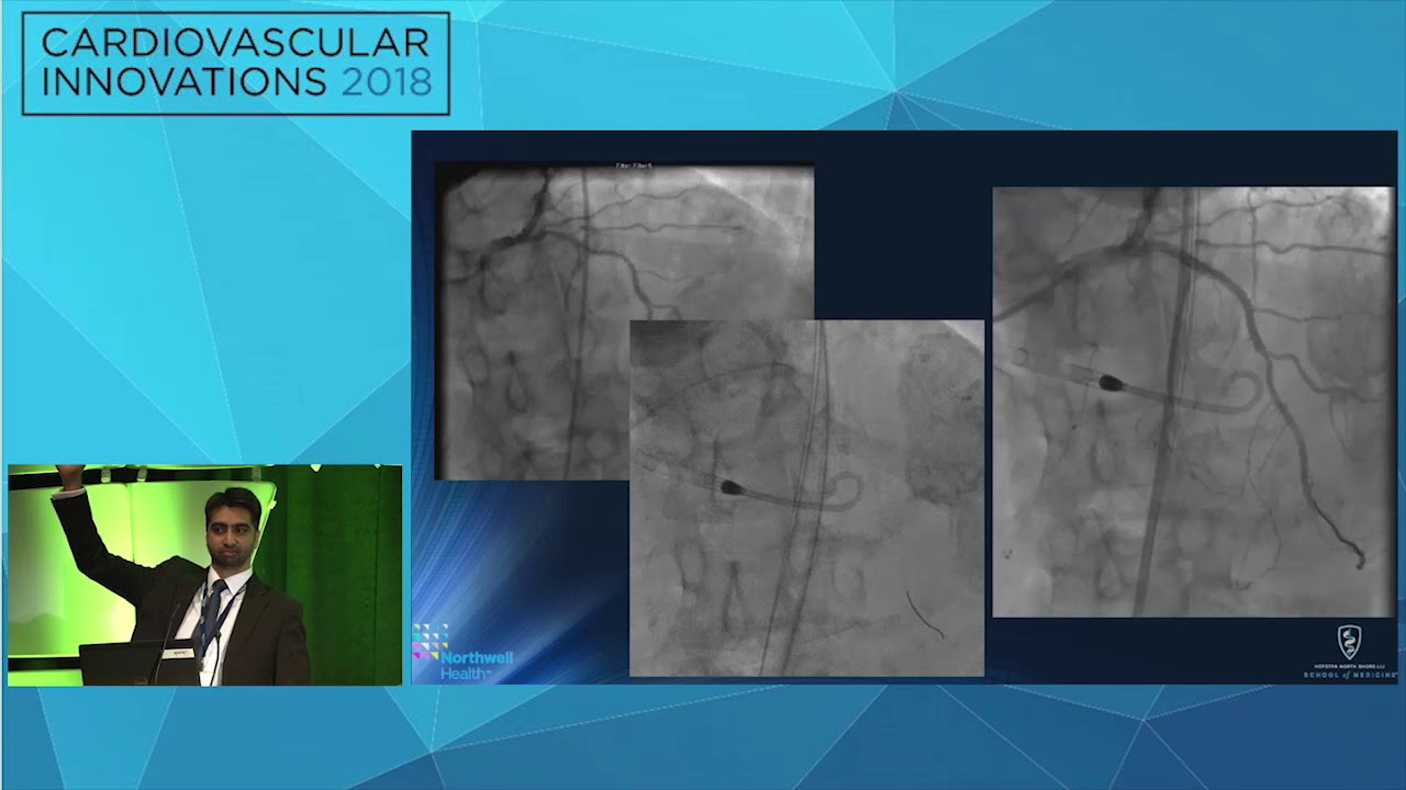 CVI2018 Session: Innovation in managing severe calcification - Perwaiz Meraj, MD
