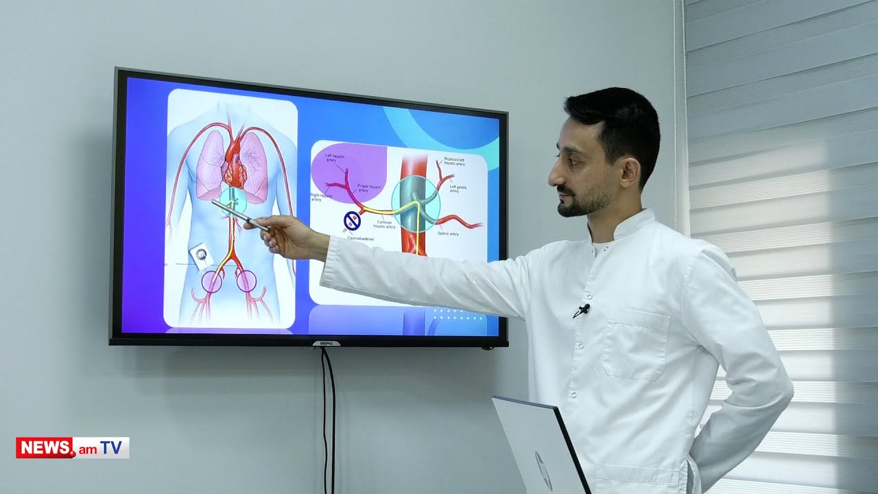 Քաղցկեղի դեղորայքային բուժման ամենաօպտիմալ մեթոդներն են թիրախային եւ իմունաթերապիան. Լեւոն Բադալյան
