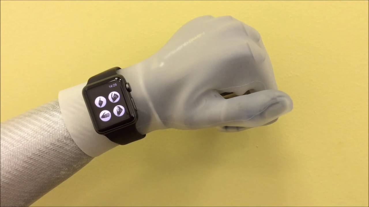 Apple Watch & i-limb quantum