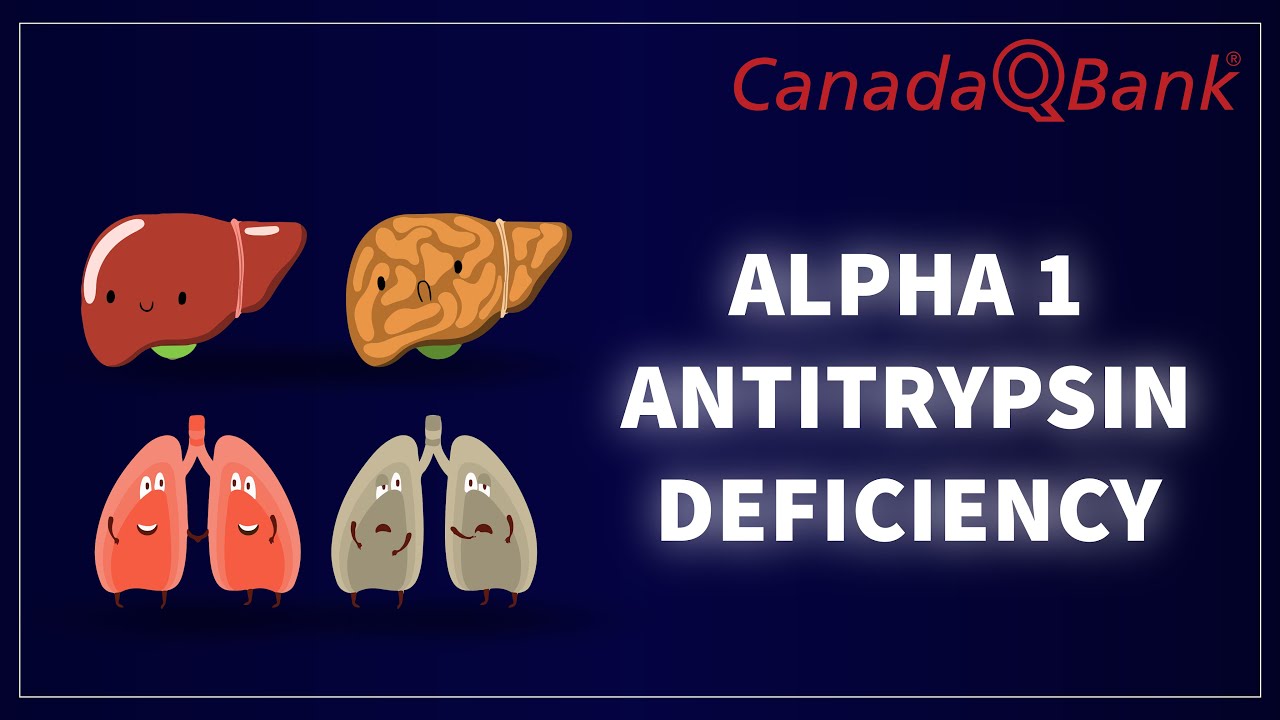 Alpha-1 Antitrypsin Deficiency: Symptoms, Diagnosis & Treatment | CanadaQBank