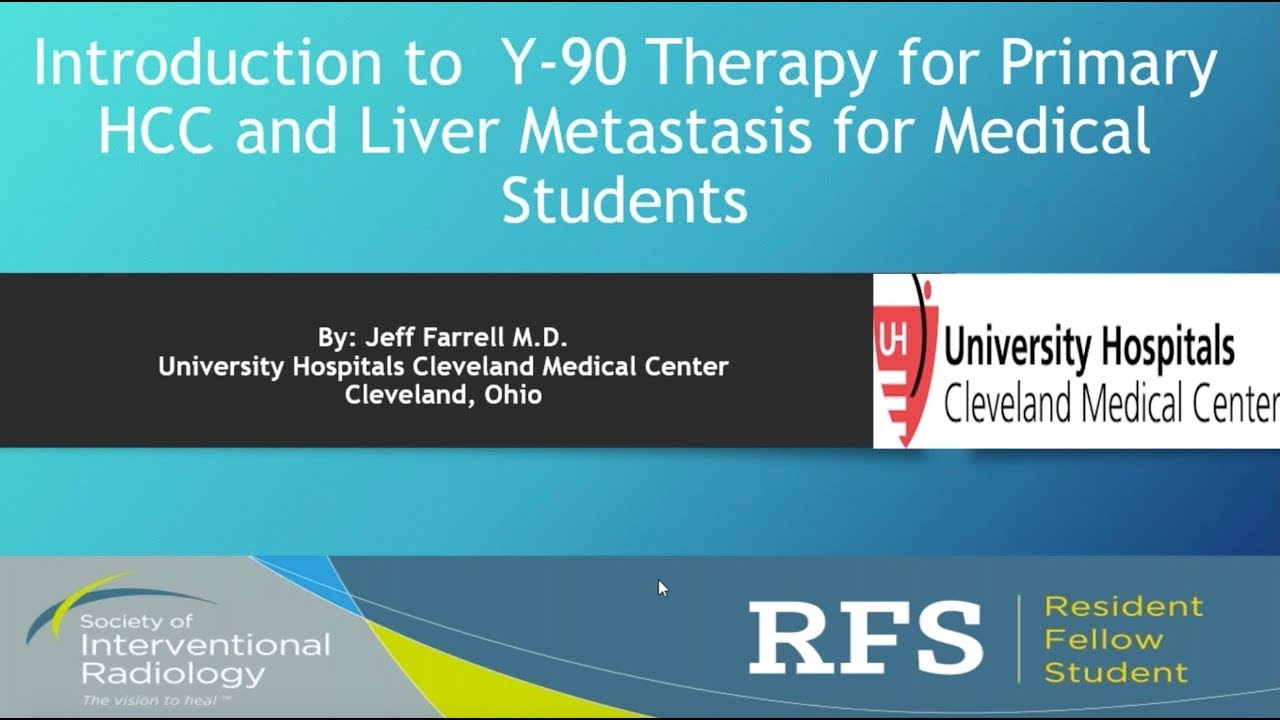 SIR-RFS Webinar (10/3/2017): Introduction to Y-90 Therapy for HCC and CRC Metastasis