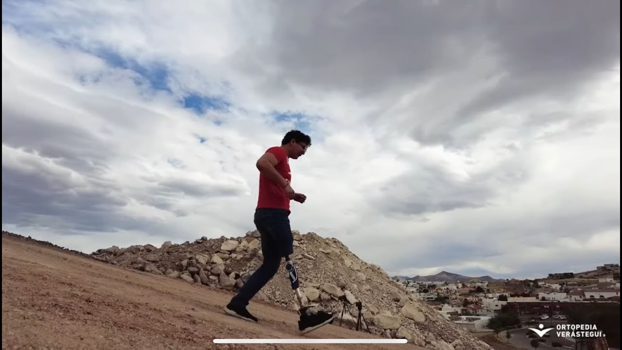 Episodio 227 la 3r80 y su freno en un cerro 😅👉🦿#prótesis #amputados #3R80