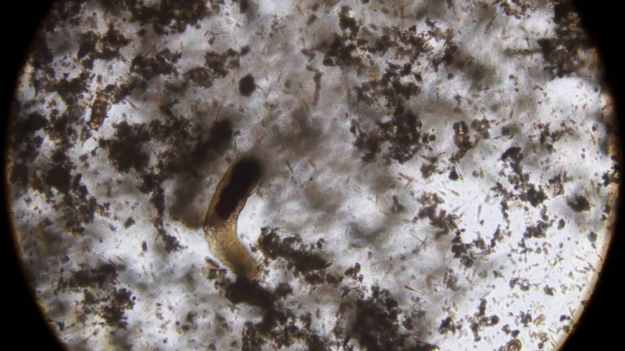 Reef tank life under the microscope