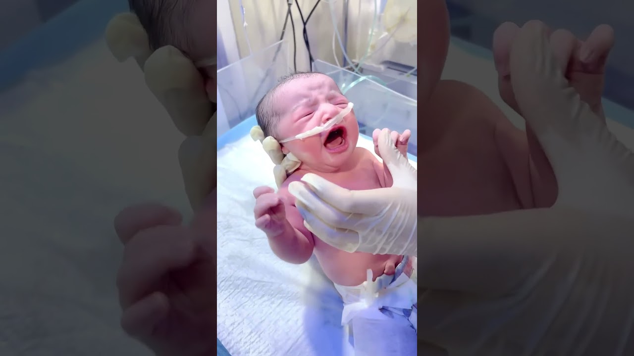 World Welcomes a Cute Baby | First Moments After Birth #miraclebaby #neonatologist #miraclebabies