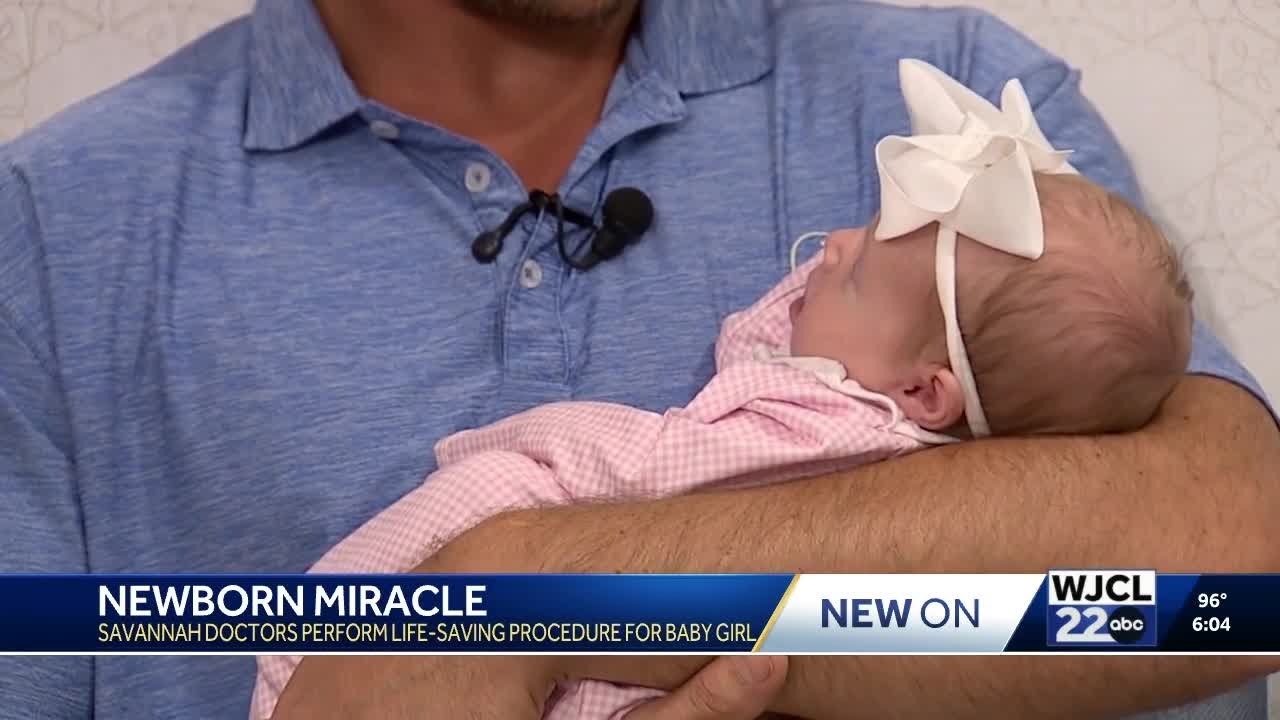 'So thankful': Savannah doctors perform rare procedure to safely deliver baby girl