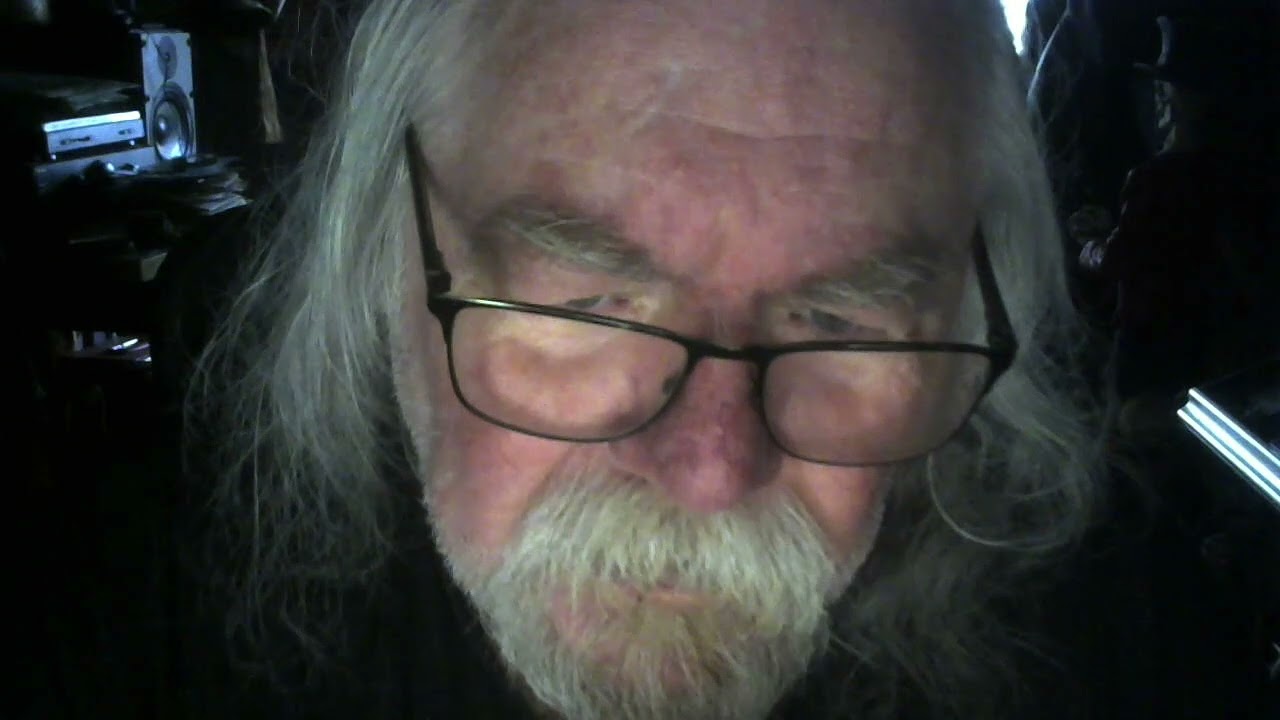 Истории из тюрем 147 Джимми Тиббса. Тони Ламбриано в «Скрабс»