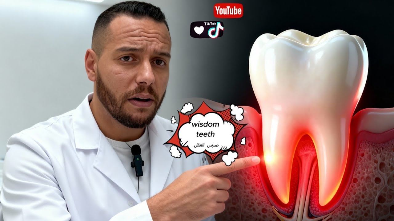 ضرس العقل والمشاكل التي تسببها #تقويم_الاسنان .. wisdom teeth and Problems they cause #orthodontist 
