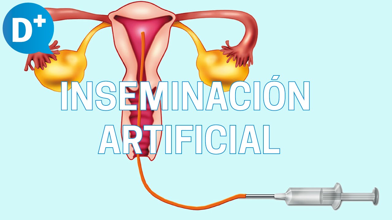 Indicaciones de la inseminación artificial