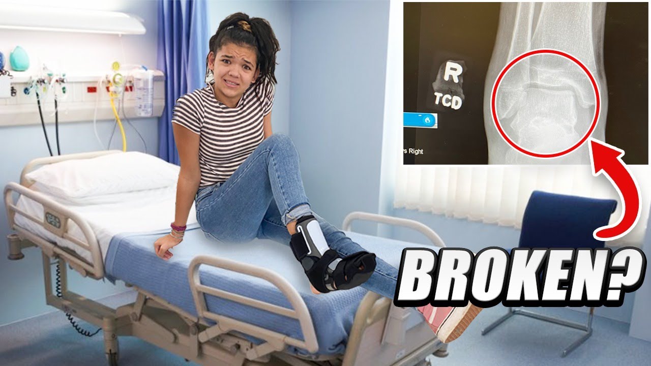 Another Foot Broken? Did Rykel have a Sprain or Break?