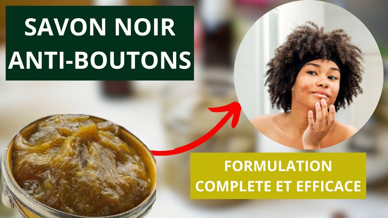 Voici comment FABRIQUER son SAVON NOIR ANTIBOUTONS