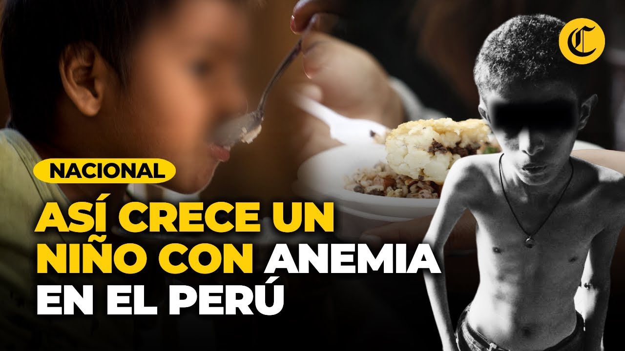 PER&Uacute;: Estas son las GRAVES SECUELAS que sufre un NI&Ntilde;O con ANEMIA