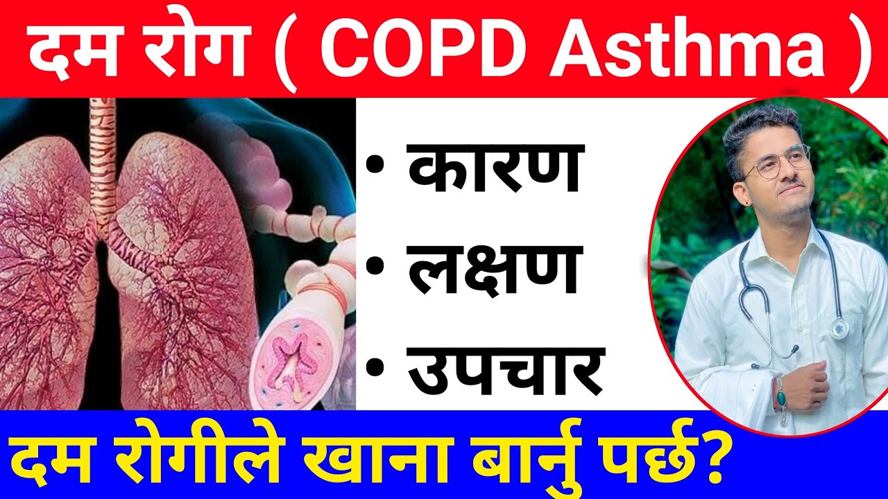 दम रोग के हो ? यसको लक्षण,कारण र उपचार | Asthma in Nepali | Causes,symptoms, treatment Rupesh Baniya