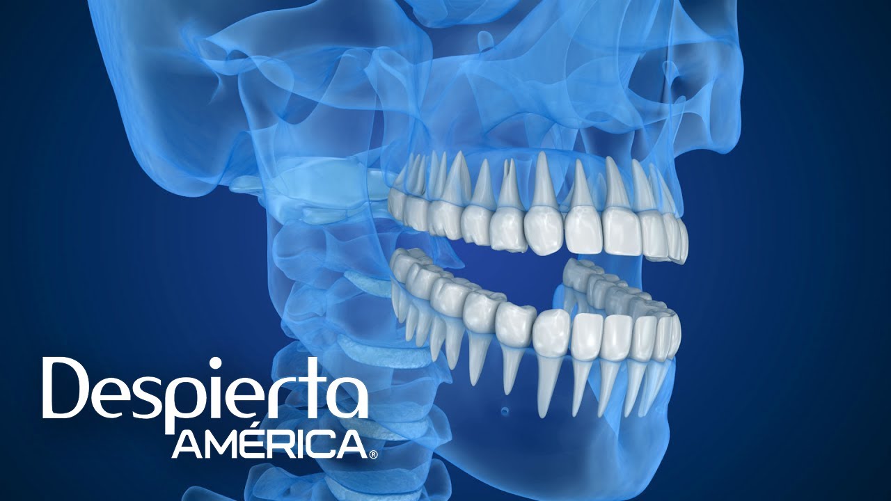 Causas m&aacute;s comunes del dolor de mand&iacute;bula