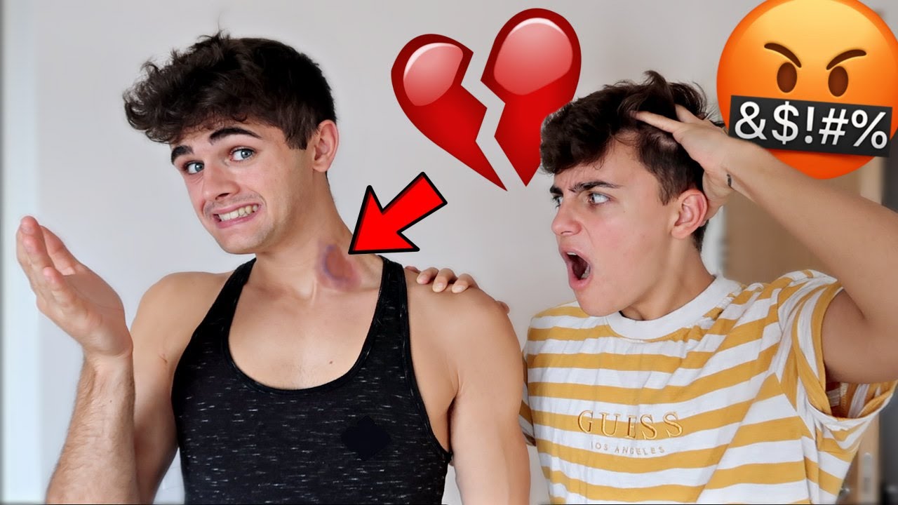 HICKEY PRANK ON BOYFRIEND (Gay Couple Prank)