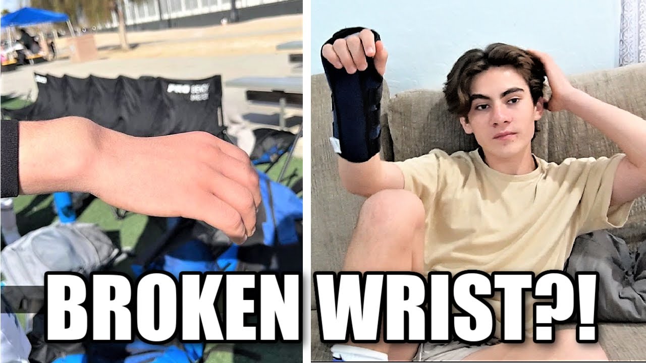 ANOTHER BROKEN BONE? ETHAN GETS AN X-RAY FOR A BROKEN OR FRACTURED WRIST INJURY | IS IT BROKEN?