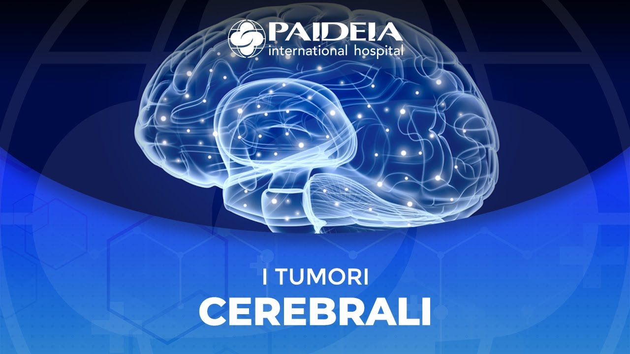 I tumori cerebrali
