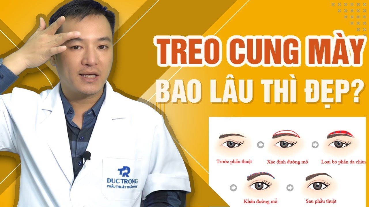 Treo cung m&agrave;y l&agrave; g&igrave; | Treo cung m&agrave;y bao l&acirc;u th&igrave; đẹp | B&aacute;c sĩ Trọng