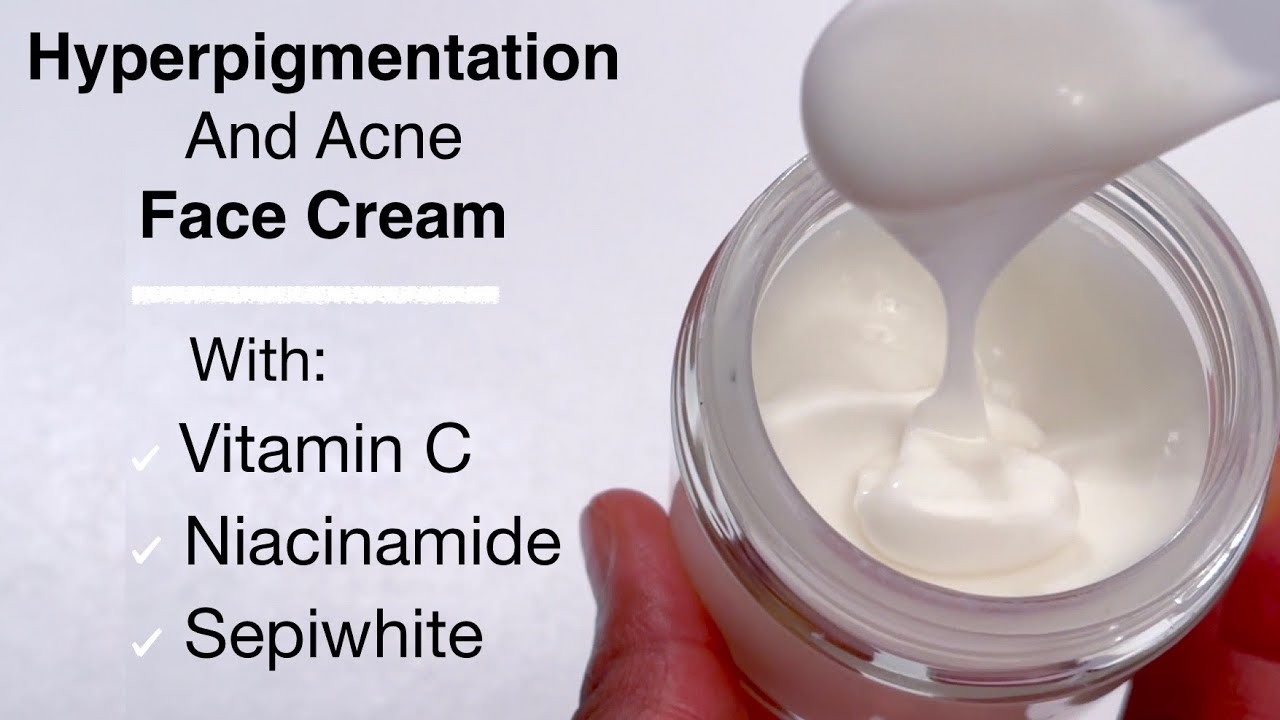 Hyperpigmentation And Acne Face Cream With Vitamin C, Niacinamide And Sepiwhite (Very Effective)