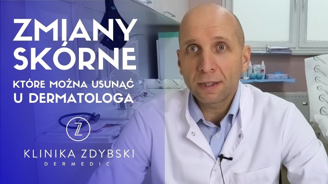 Zmiany skórne, które można usunąć u dermatologa