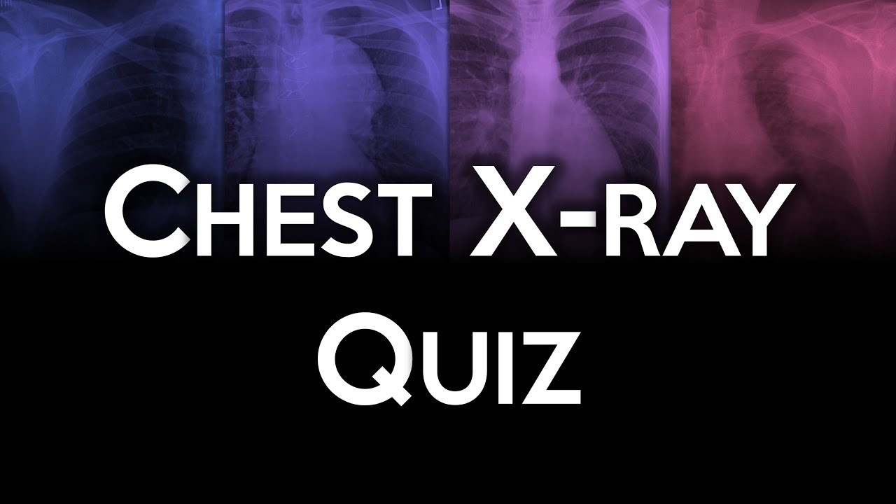 Chest X-ray Quiz Challenge