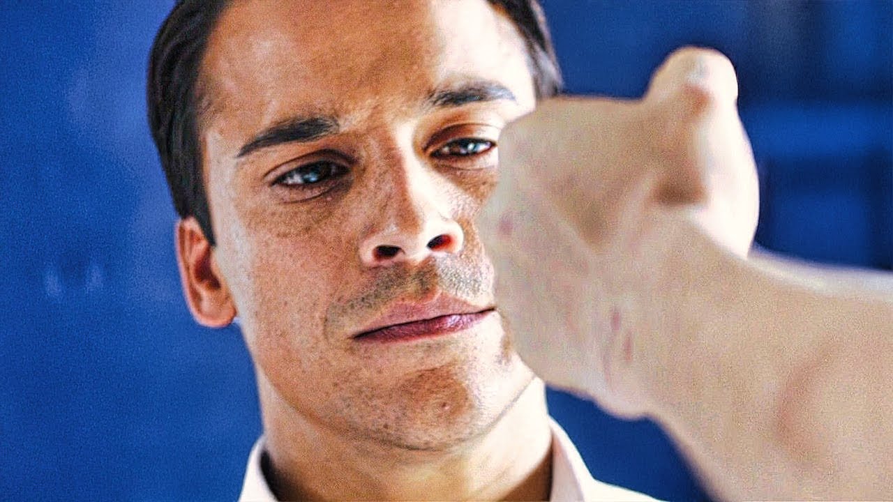 He Lost 95% Of His Vision, But Even His Girlfriend Didn't Believe He Was Blind. True Story