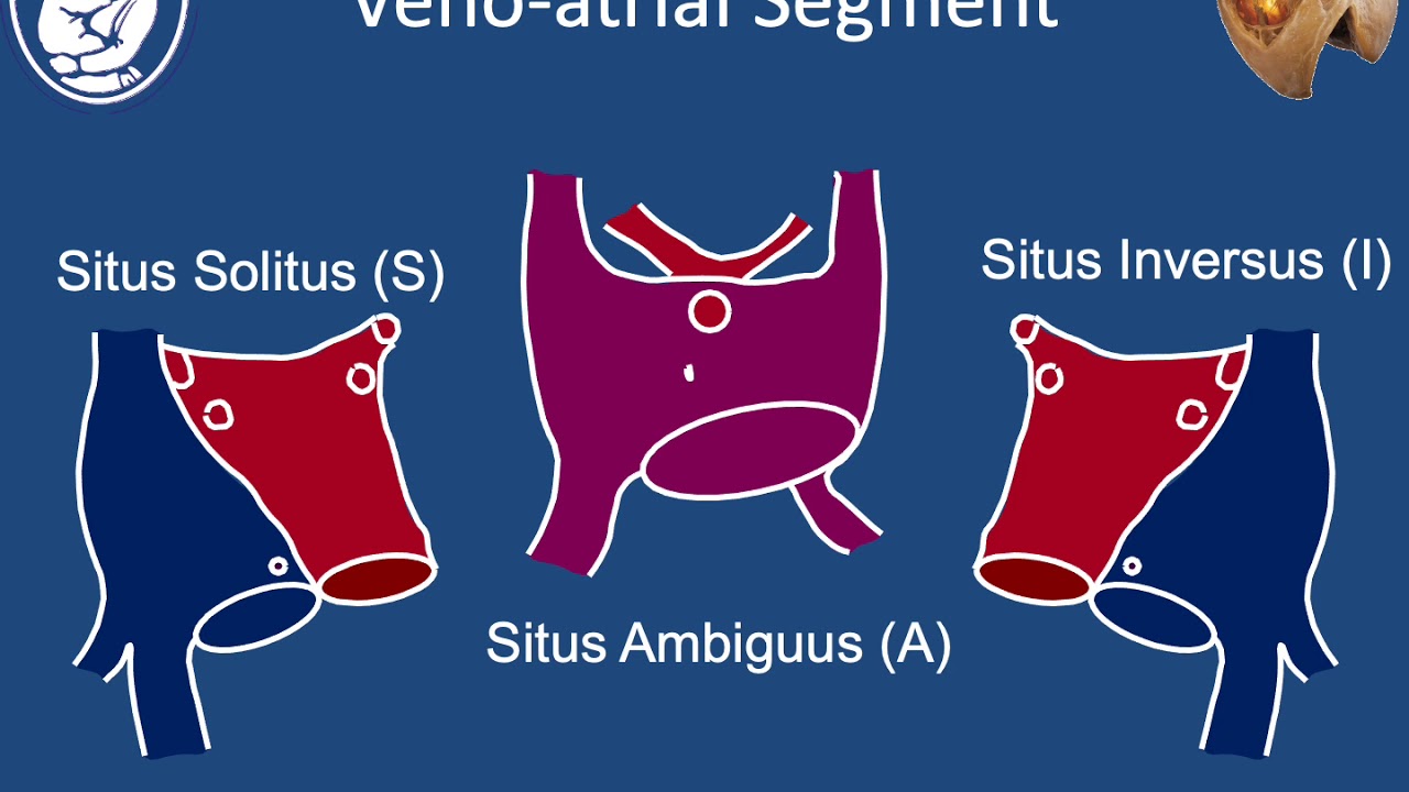 Cardiac nomenclature -Stephen Sanders, MD
