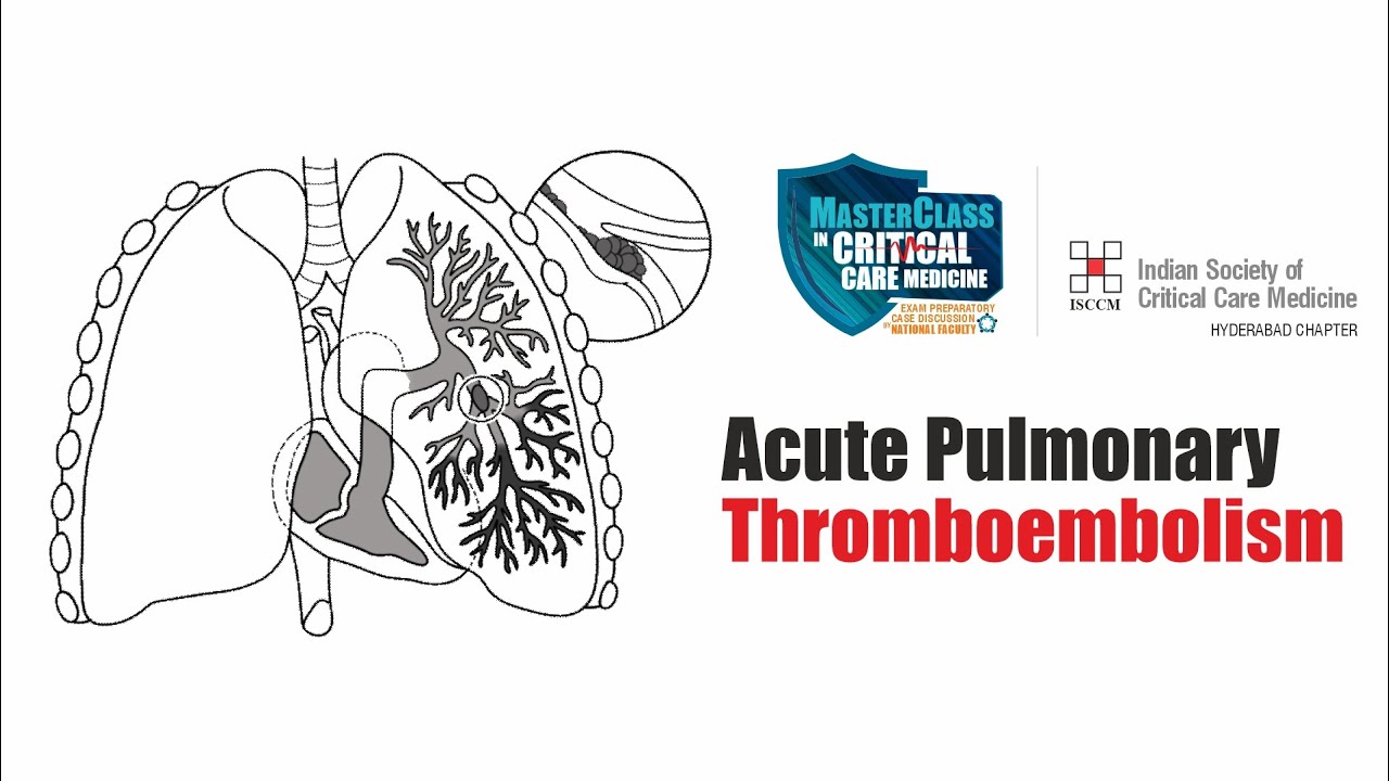 MasterClass in Critical Care Medicine | Acute Pulmonary Thromboembolism | Yashoda hospitals