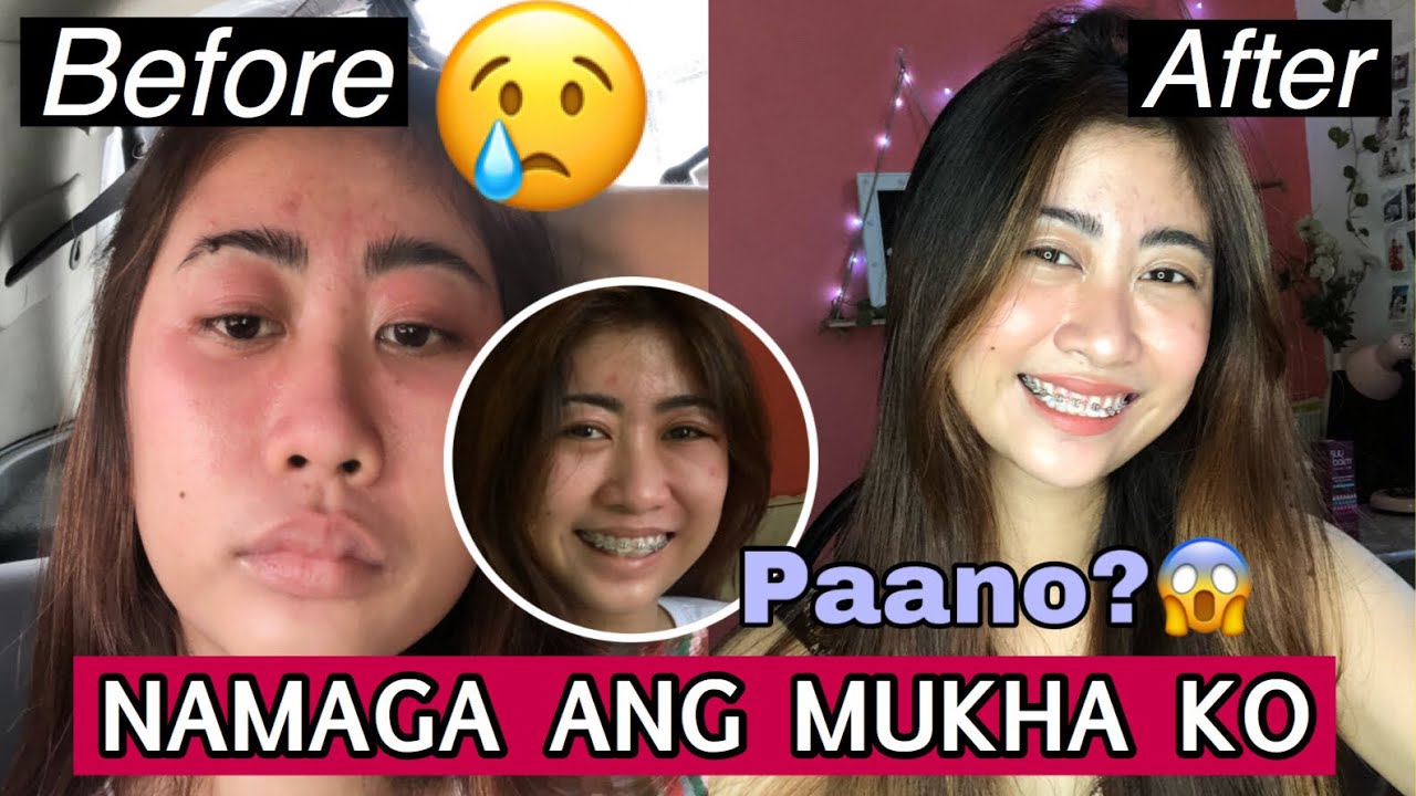 NAMAGA ANG MUKHA KO DAHIL SA ISANG PRODUCT! 😭 + SINUGOD AKO SA HOSPITAL.😢  |Maestra Quia ✨