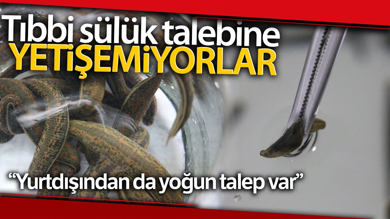 Tıbbi Sülük Talebine Yetişemiyorlar, Milyonlarca Üretilip Dünyaya Satılıyor
