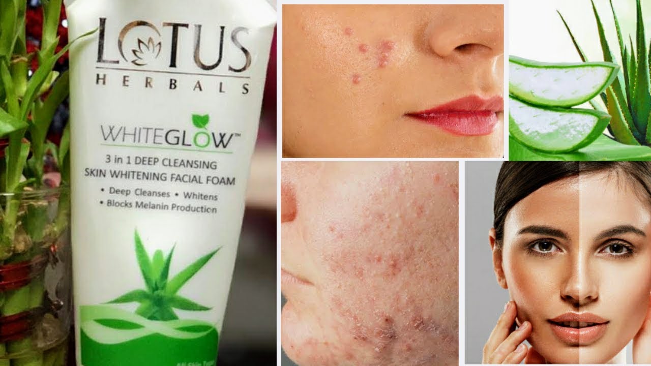 #Lotus #Herbals Face Wash | Best Face Wash for Women | Skin Care