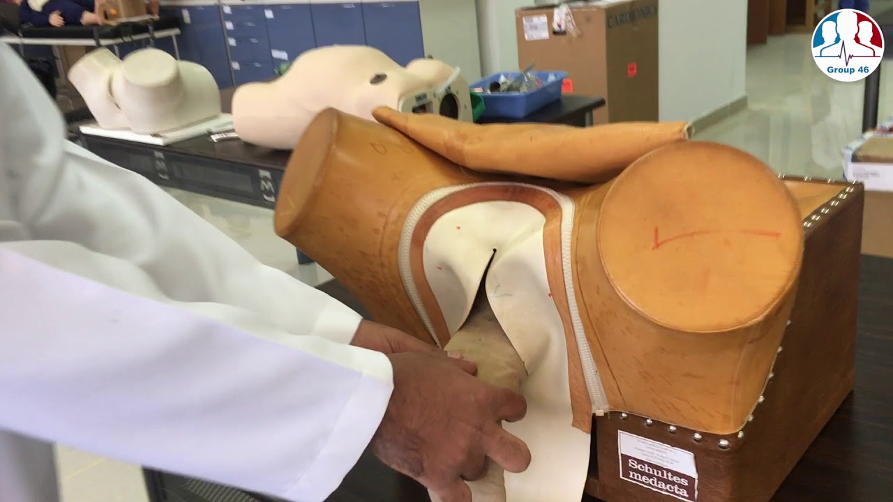 Breech presentation