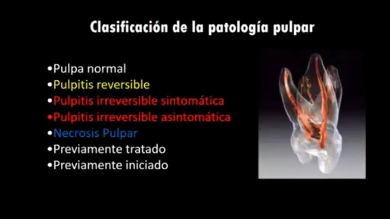 Pruebas diagnósticas en endodoncia