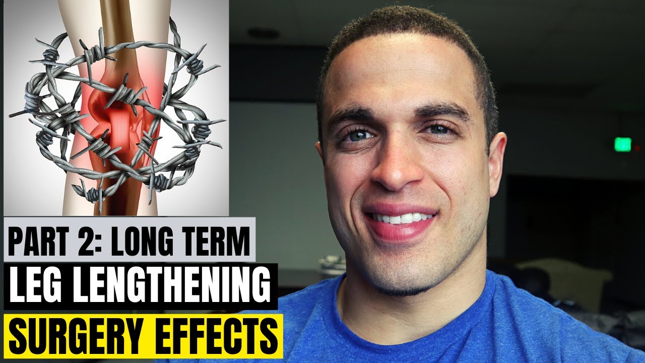 Potential Long-Term Effects of Limb Lengthening Surgery...Part 2