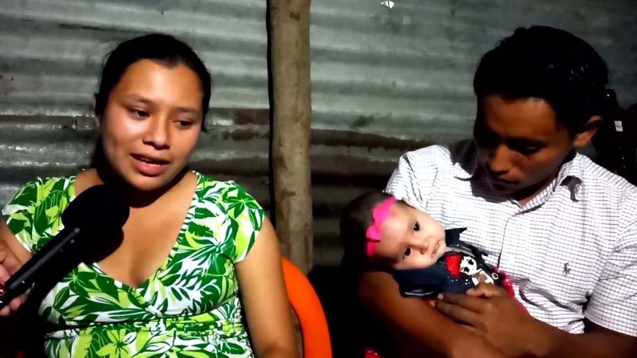 Ni&ntilde;a nicarag&uuml;ense con focomelia
