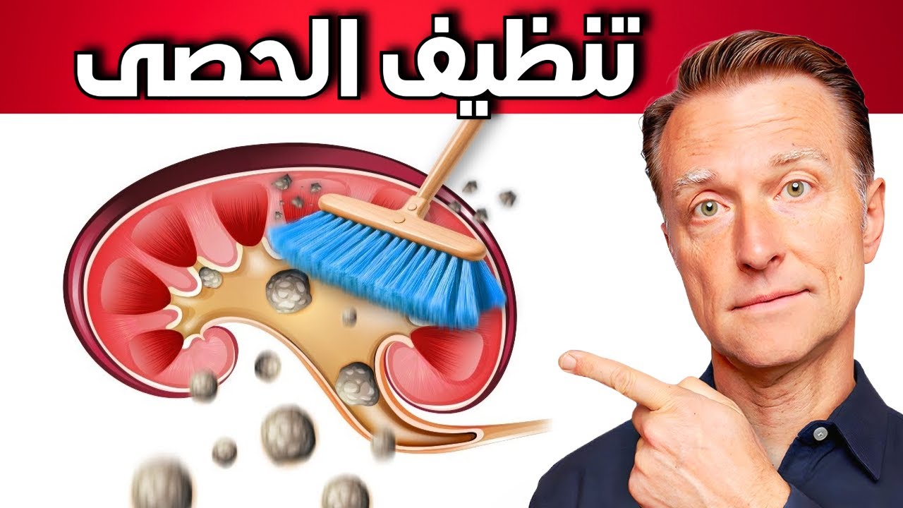 طريقة سهلة لتقليل الأكسالات في الأطعمة لمنع حصى الكلى