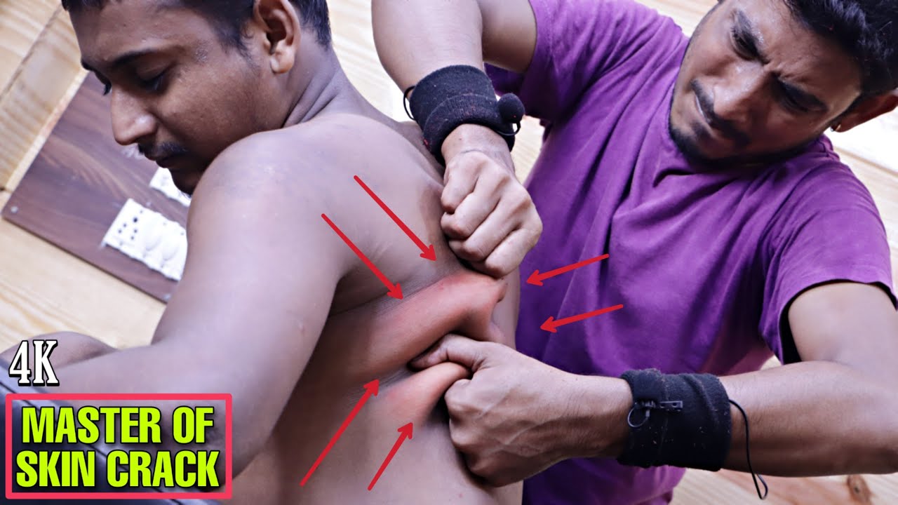 Head & Body massage with Lots of Loud Crack / Neck, Skin, Ear, Spine cracking / Intense ASMR
