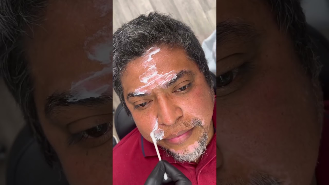 Vitiligo Care ✅ #vitiligocure #permanentmakeup #pmu