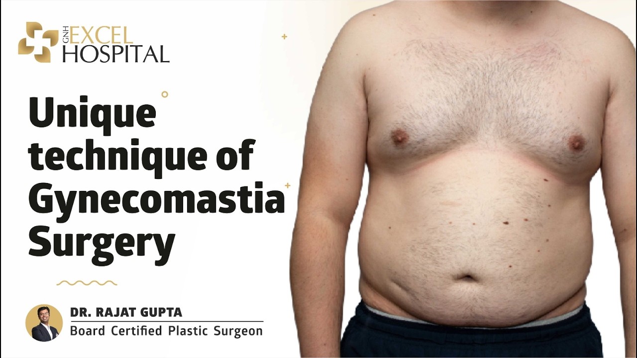 Unique technique of Gynecomastia Surgery | Dr Rajat Gupta , Plastic Surgeon , Excel Hospital