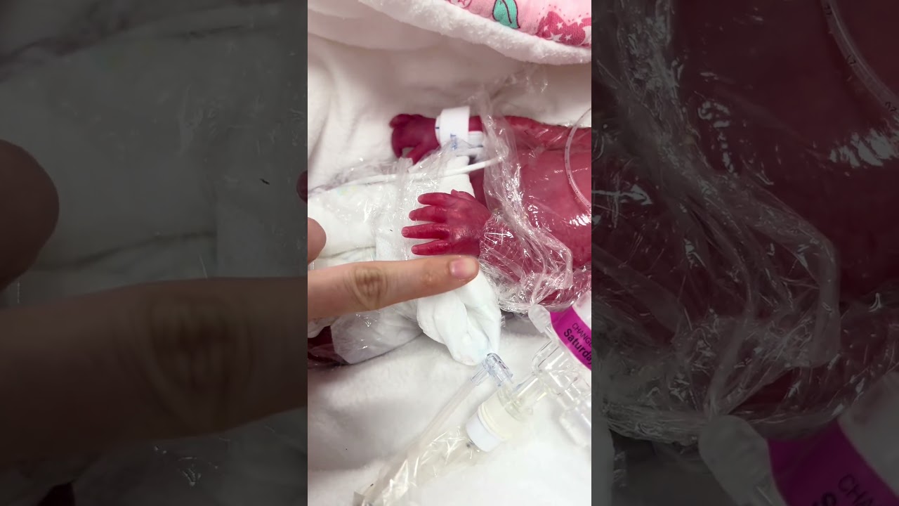 _Beyond the glass. Full of hope #NICU #PrematureBaby #NICUJourney #NICUNurse #SafeAndWell #Newborn