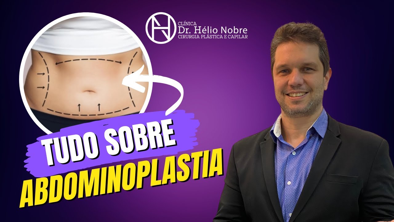 Tudo sobre ABDOMINOPLASTIA | Dr. Hélio Nobre | Cirurgião Plástico