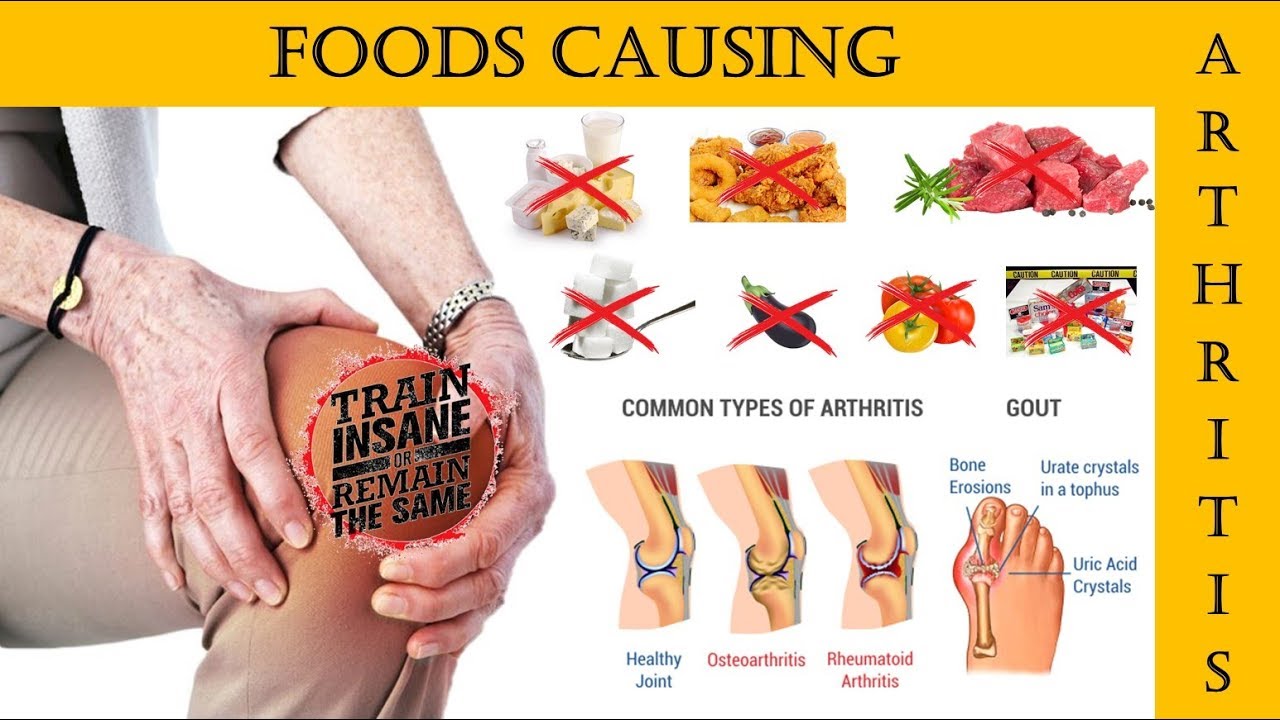 Foods Causing Arthritis