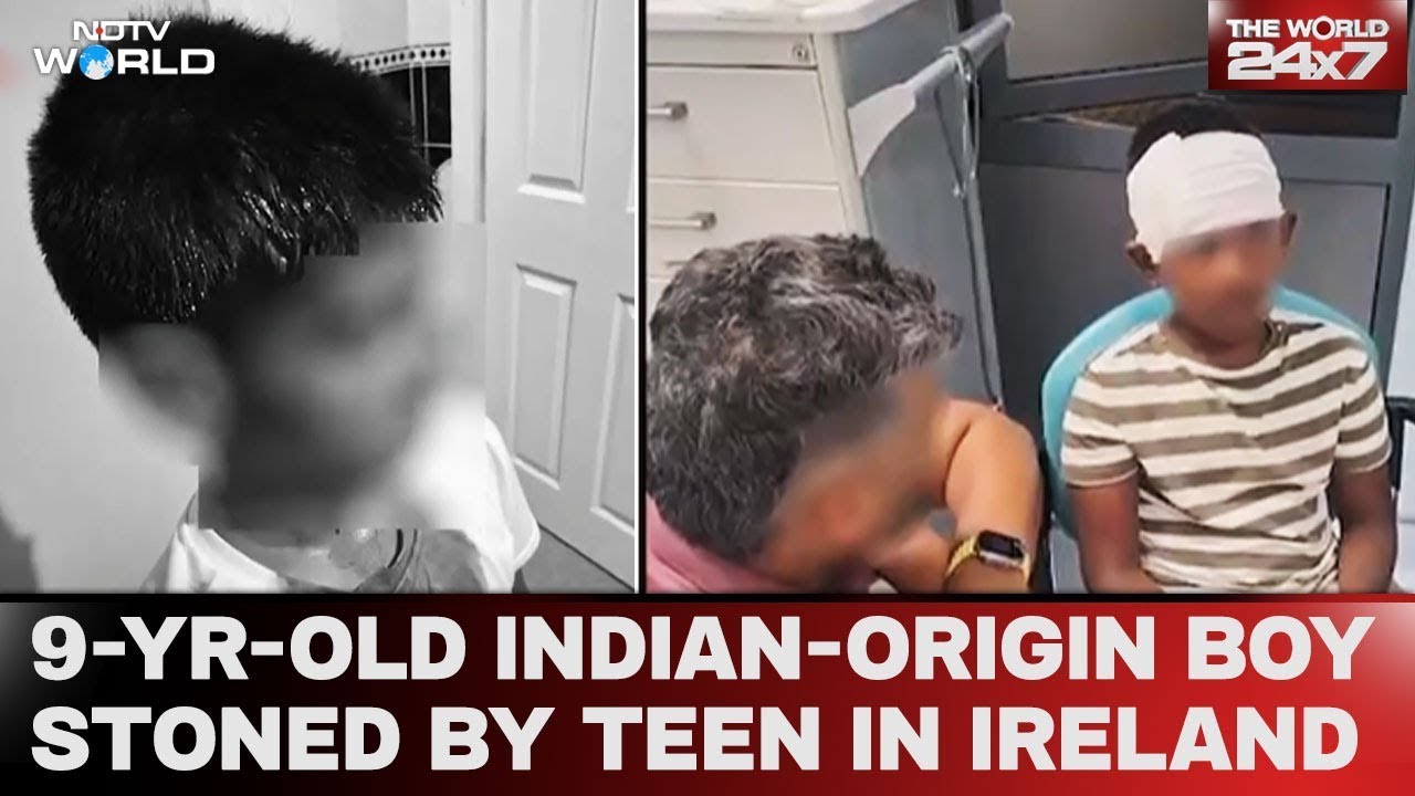 Ireland News | 9-Year-Old Indian-origin Boy Stoned By Teen In Ireland, Family Calls It Racist Attack