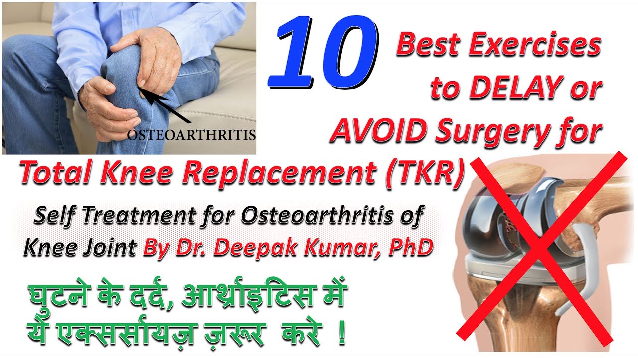 Delay/Avoid Knee Replacement TKR surgery in early age| घर पर घुटने के दर्द /आर्थ्राइटिस का इलाज।