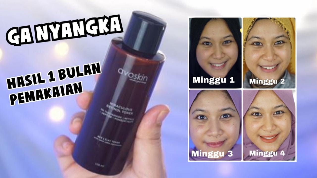 AVOSKIN MIRACULOUS RETINOL TONER REVIEW