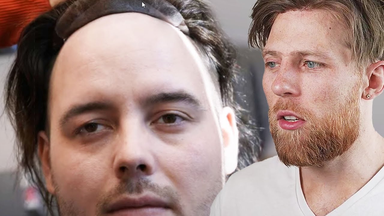 Learn These Lessons from High Quality Hair System Transformations