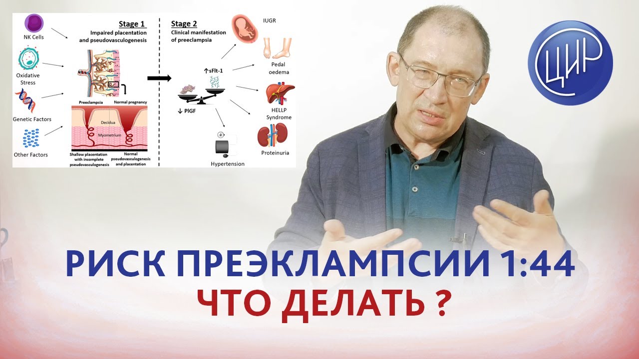 Высокий риск преэклампсии по результатам первого скрининга - что делать? Отвечает Гузов И.И.