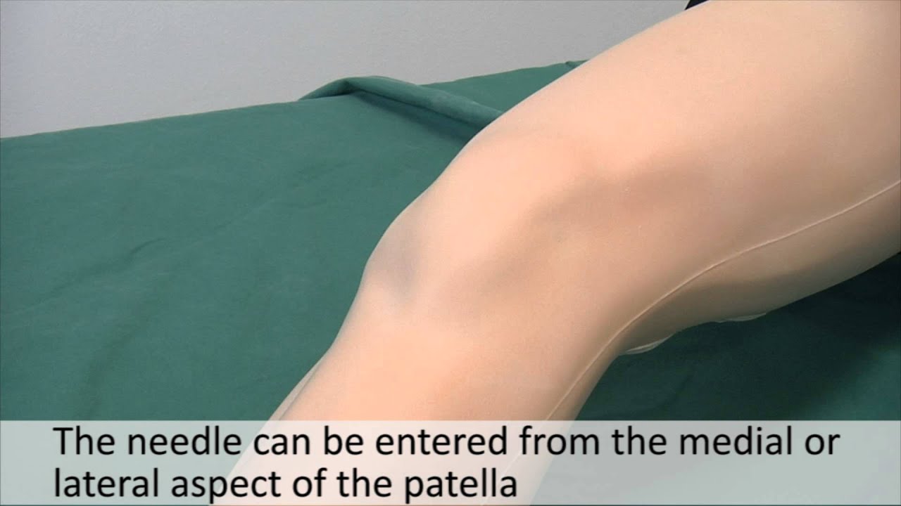 Musculoskeletal Examination and Joint Injection Series_ Knee Joint Aspiration