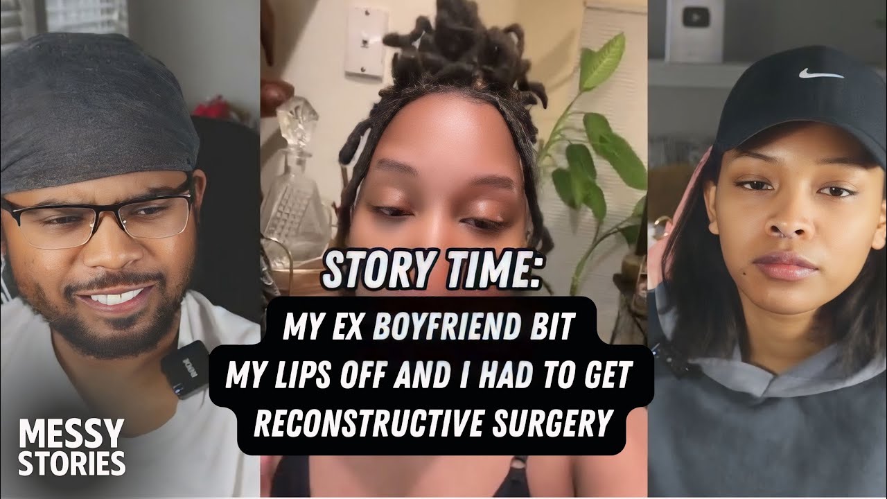 Her Boyfriend Bit Her Lips Off She Needed Reconstructive Surgery